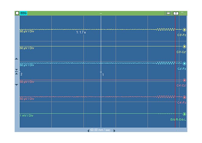 ISIS Software EEG